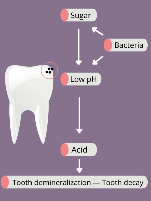 Why Sugar is Bad for Your Teeth Dental World Marietta, GA